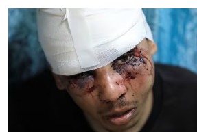 Injured Gaza man says Israeli troops beat him